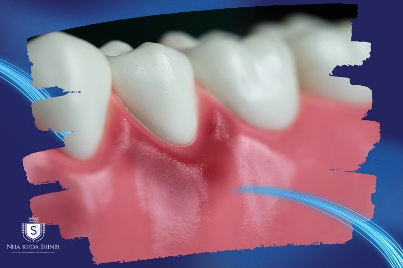 Tình trạng răng miệng ban đầu Tình trạng răng miệng ban đầu