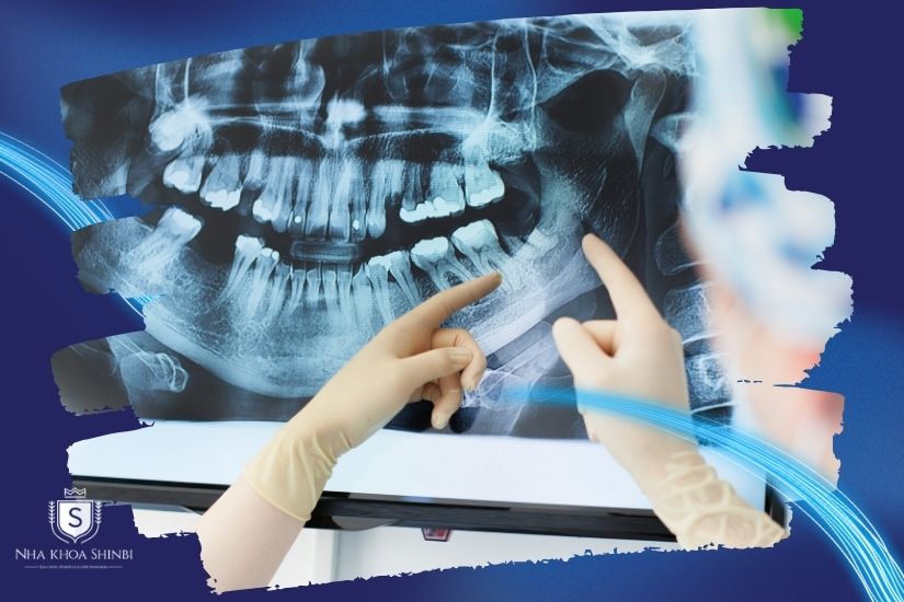 Thăm khám & chụp phim Thăm khám & chụp phim