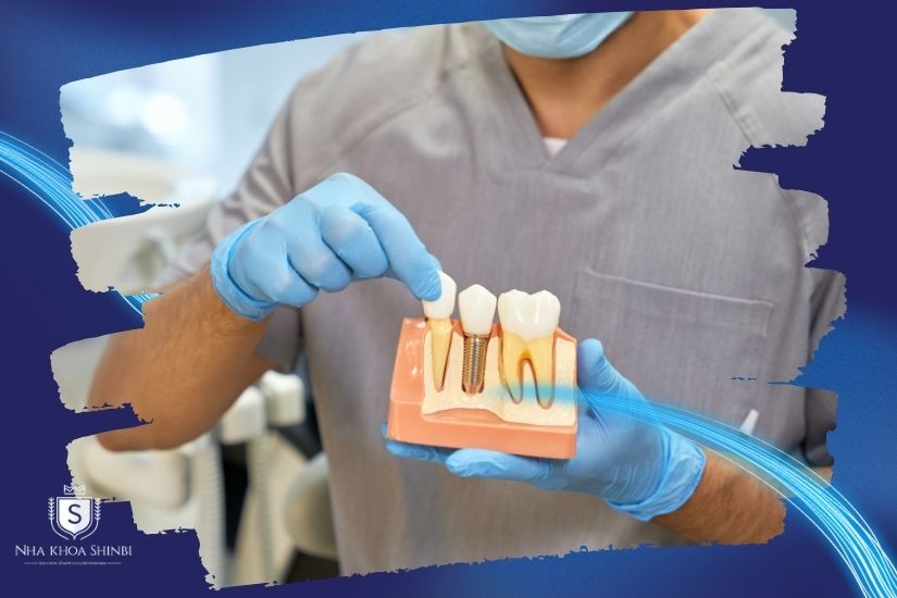 Tay nghề bác sĩ chuyên môn cao Tay nghề bác sĩ chuyên môn cao