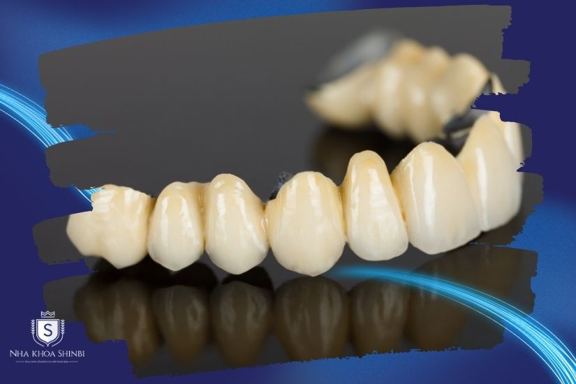 Khám phá làm răng sứ nhanh