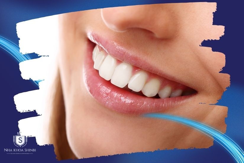 Làm răng sứ nhanh trong bao lâu?