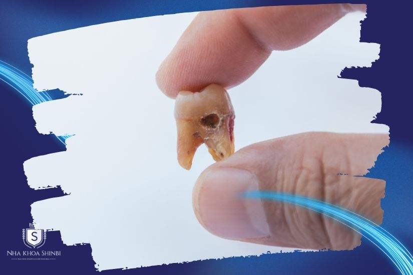 Tình trạng ban đầu ảnh hưởng đến thời gian