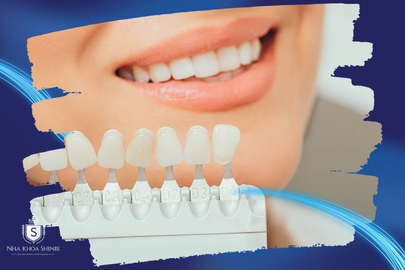 Lợi ích khi làm tại nha khoa uy tín