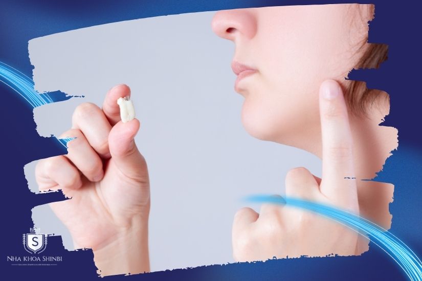 Giải đáp thắc mắc liệu nhổ răng khôn có hết hôi miệng