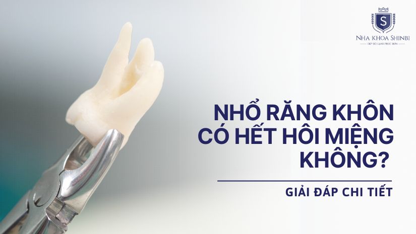 Nhổ răng khôn có hết hôi miệng không? Giải đáp chi tiết