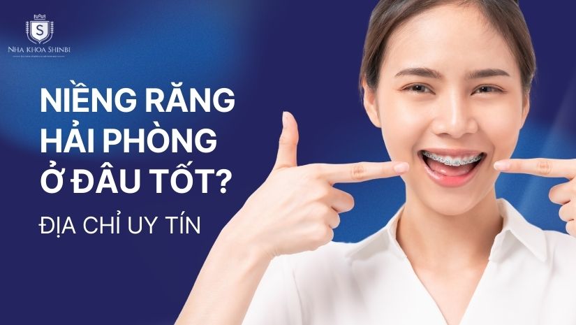 Niềng răng Hải Phòng ở đâu tốt? Gợi ý địa chỉ uy tín