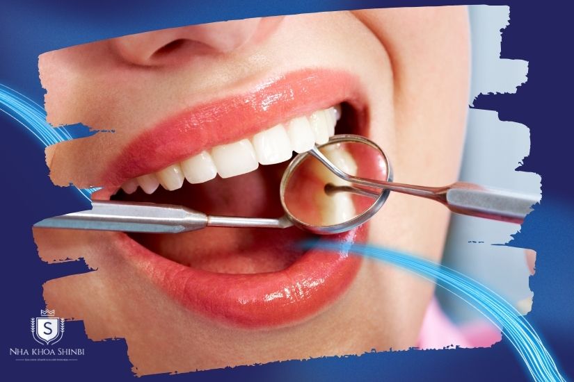 Đảm bảo an toàn cho răng miệng Đảm bảo an toàn cho răng miệng