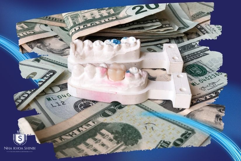 Chi phí tương đối cao Chi phí tương đối cao