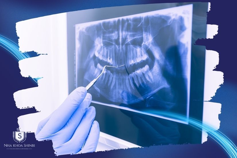 Công nghệ chụp răng hiện đại Công nghệ chụp răng hiện đại