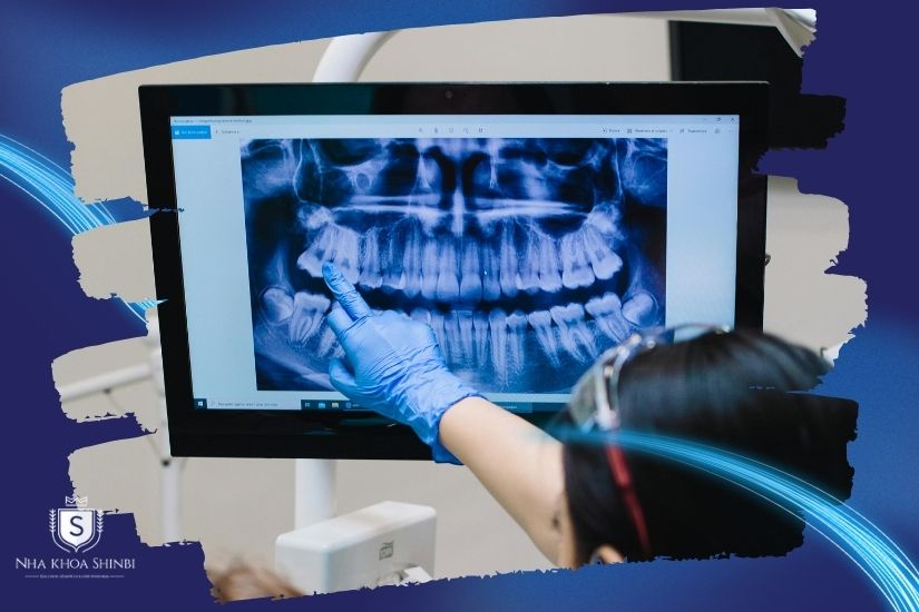 Thăm khám và chụp phim X-quang Thăm khám và chụp phim X-quang