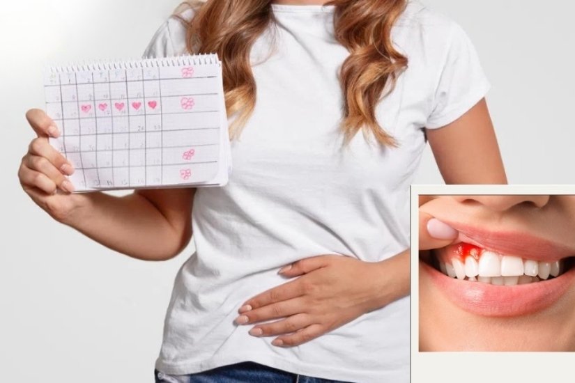 Ảnh hưởng của chu kỳ kinh khi làm răng