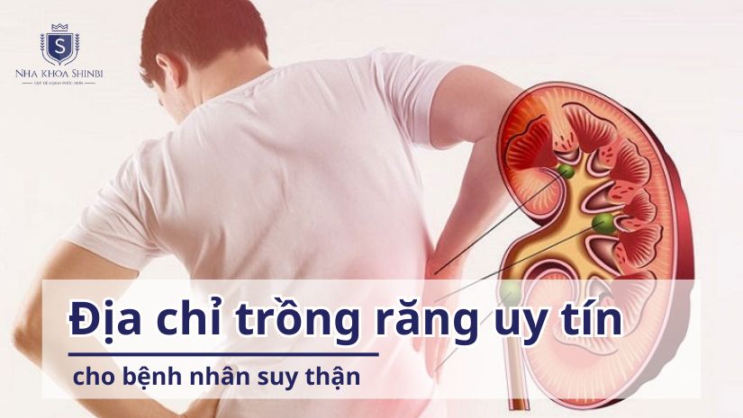 Địa chỉ trồng răng uy tín cho bệnh nhân suy thận