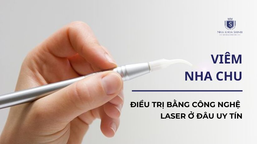 Điều trị viêm nha chu bằng công nghệ laser ở đâu hiệu quả?