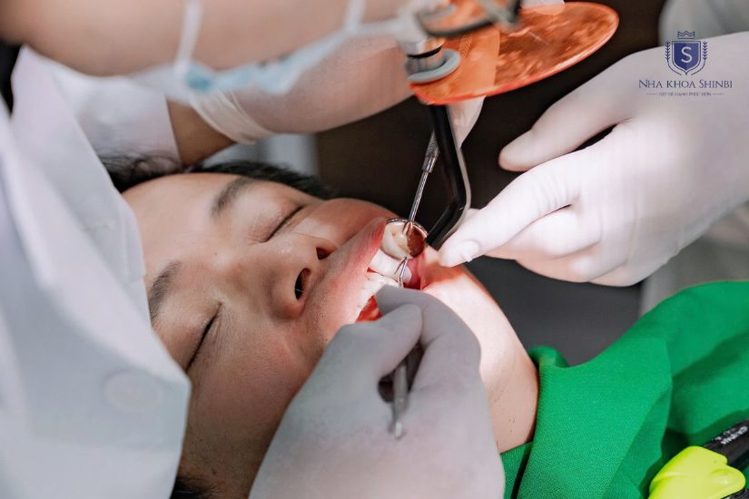 Điều trị viêm nha chu tại Nha khoa Shinbi