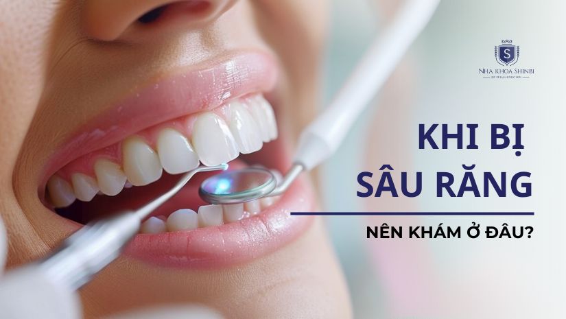 Khi bị sâu răng nên đi khám ở đâu?