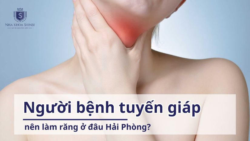 Người bệnh tuyến giáp nên làm răng ở đâu Hải Phòng?