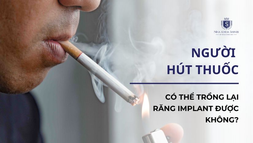 Người hút thuốc có thể trồng lại răng Implant được không?