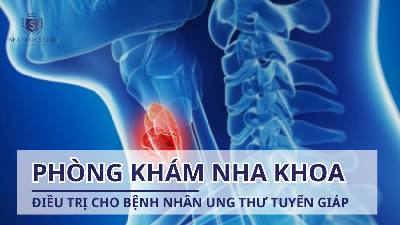 Phòng khám nha khoa điều trị cho bệnh nhân ung thư tuyến giáp