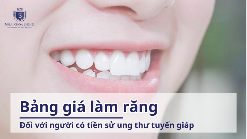 Bảng giá làm răng cho người có tiền sử ung thư tuyến giáp