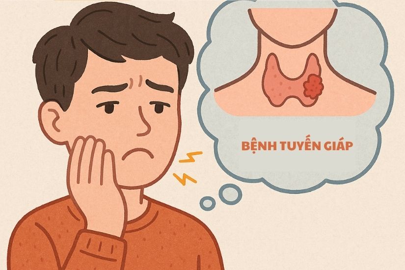 Bệnh tuyến giáp ảnh hưởng gì đến sức khỏe răng miệng