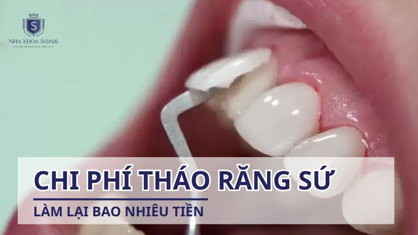 Chi phí tháo răng sứ làm lại bao nhiêu tiền?