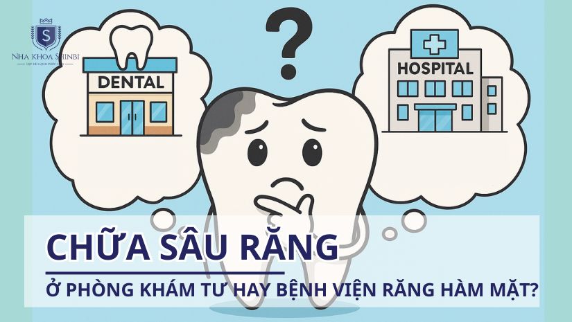 Chữa răng sâu ở phòng khám tư hay bệnh viện răng hàm mặt?