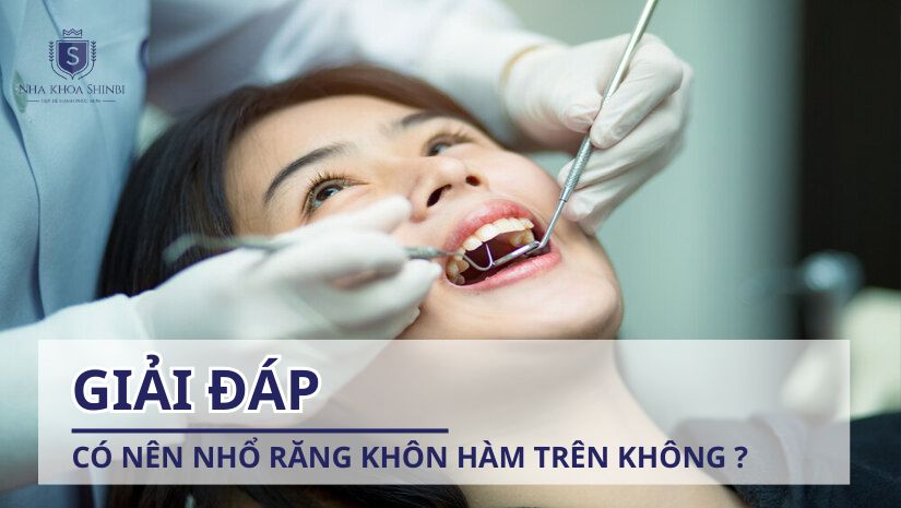 Giải đáp: Có nên nhổ răng khôn hàm trên không?