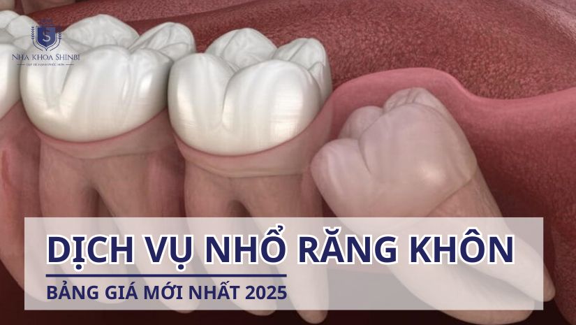 Dịch vụ nhổ răng khôn hiện nay, bảng giá mới nhất 2025