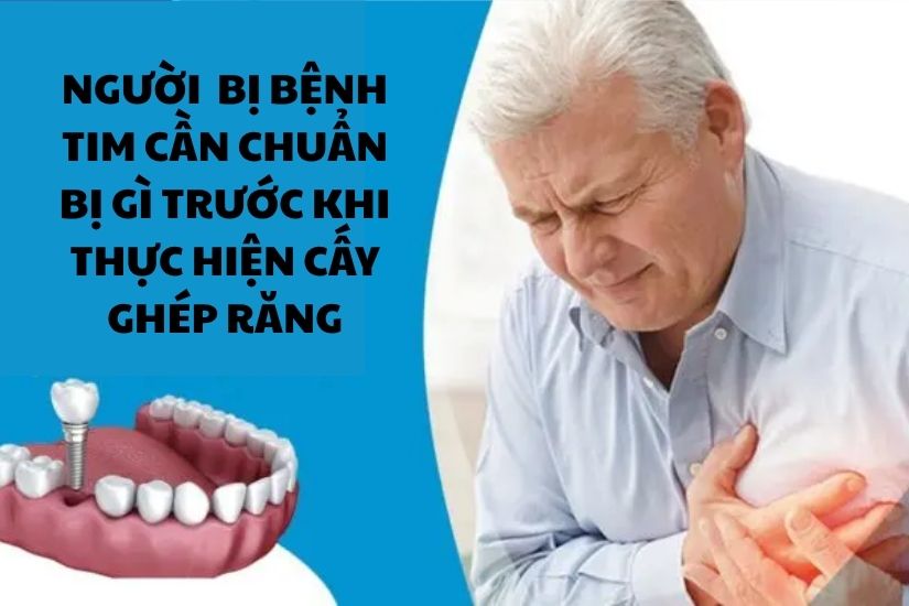 Người bệnh tim cần chuẩn bị gì trước khi thực hiện cấy ghép răng? Người bệnh tim cần chuẩn bị gì trước khi thực hiện cấy ghép răng?