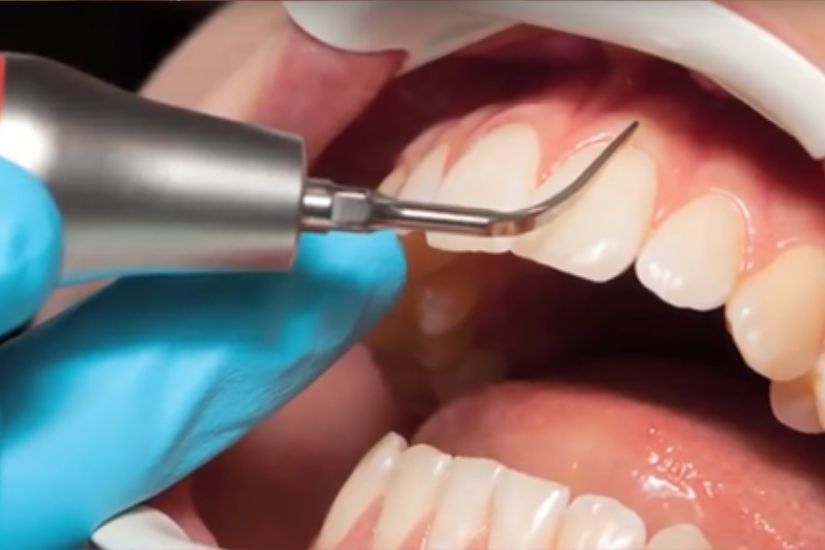 Những phương pháp điều trị phổ biến hiện nay Những phương pháp điều trị phổ biến hiện nay