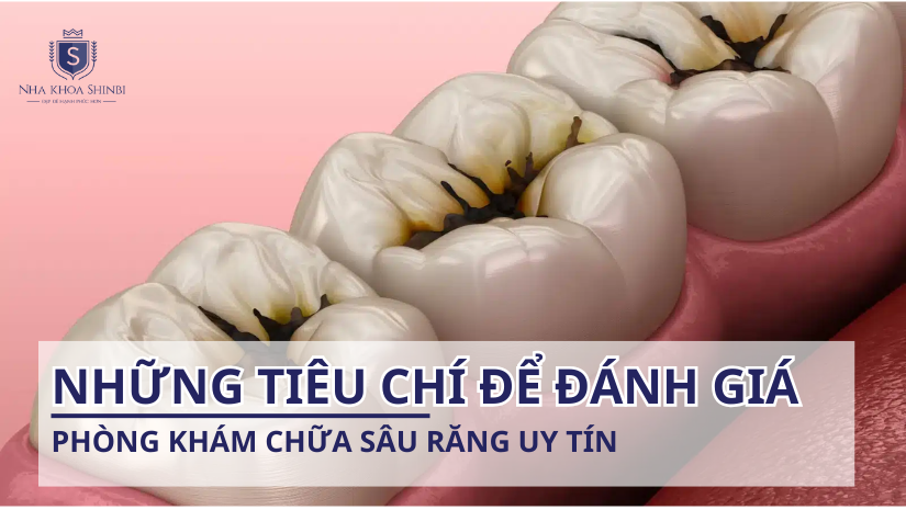 Những tiêu chí đánh giá phòng khám chữa sâu răng uy tín
