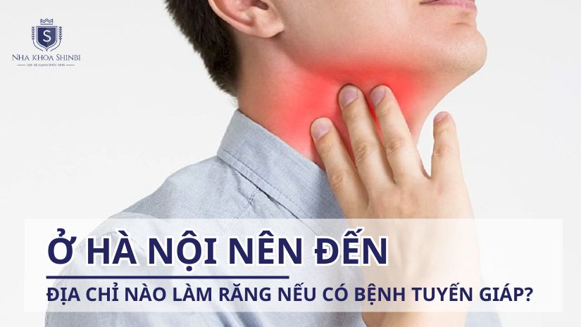 Ở Hà Nội nên đến địa chỉ nào làm răng nếu có bệnh tuyến giáp?
