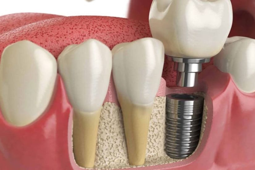 Theo dõi sức khỏe kỹ lưỡng Theo dõi sức khỏe kỹ lưỡng