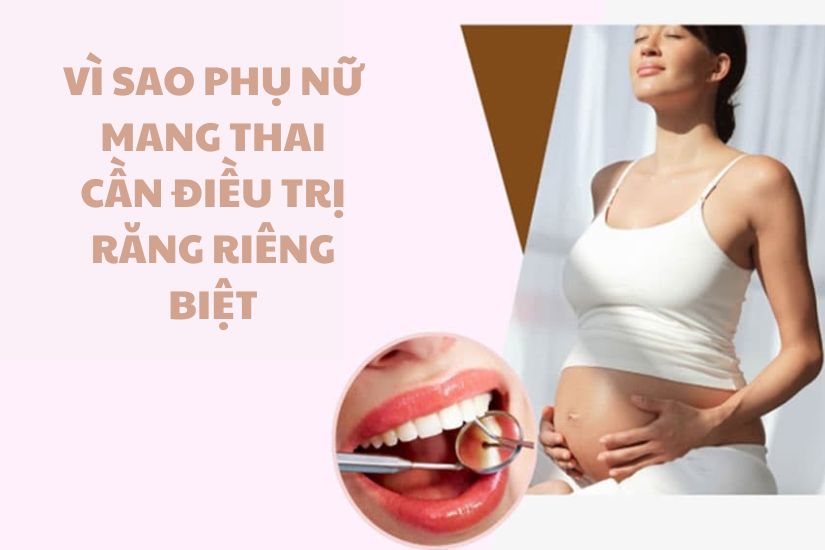 Vì sao phụ nữ mang thai cần điều trị răng riêng biệt Vì sao phụ nữ mang thai cần điều trị răng riêng biệt