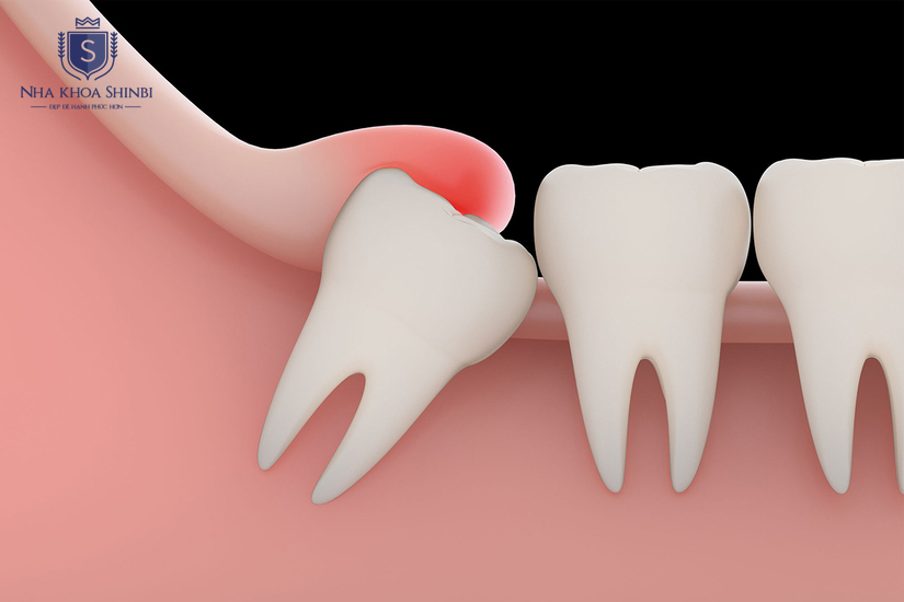 Bác sĩ tư vấn kỹ lưỡng trước khi đưa ra chi phí