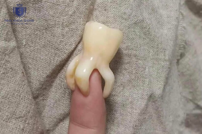 Mức giá hợp lý cho dịch vụ chất lượng