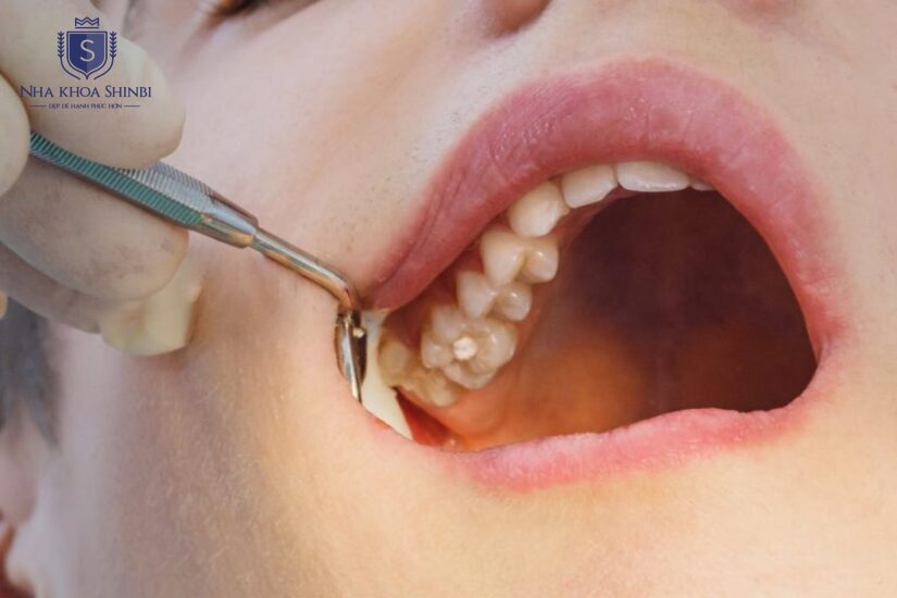 Đầu tư một lần cho trải nghiệm an toàn