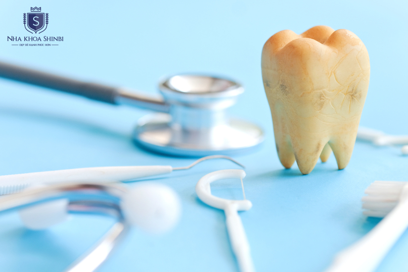 Vệ sinh vùng điều trị giúp quá trình diễn ra an toàn