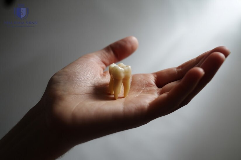 Nhổ răng không còn đáng sợ nhờ công nghệ hỗ trợ