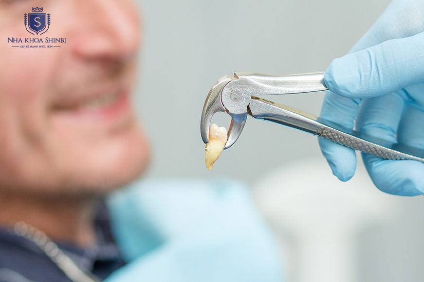 Không lo phát sinh thêm trong quá trình điều trị