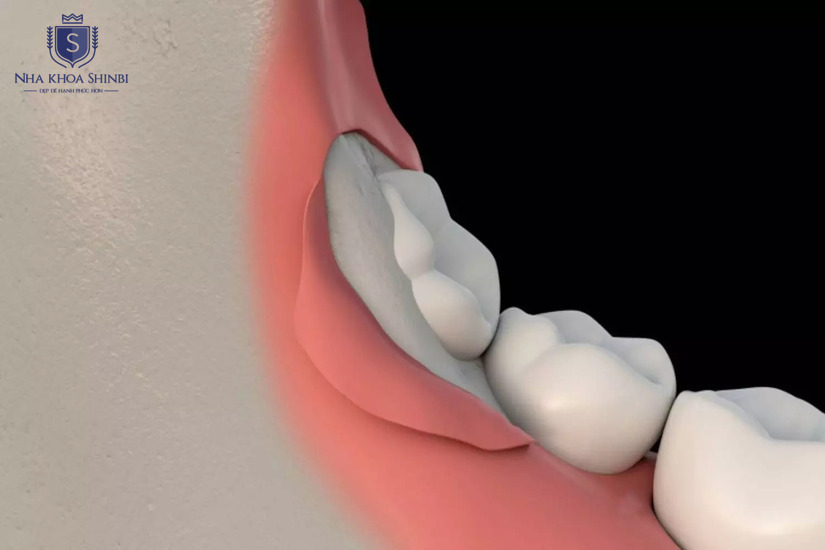 Nhiều lựa chọn chi phí phù hợp với nhu cầu