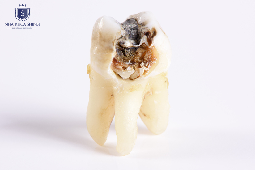 Shinbi ứng dụng công nghệ để tối ưu trải nghiệm điều trị