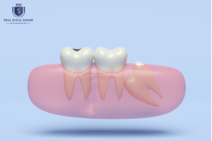 Vệ sinh kỹ lưỡng để đảm bảo kết quả tốt nhất