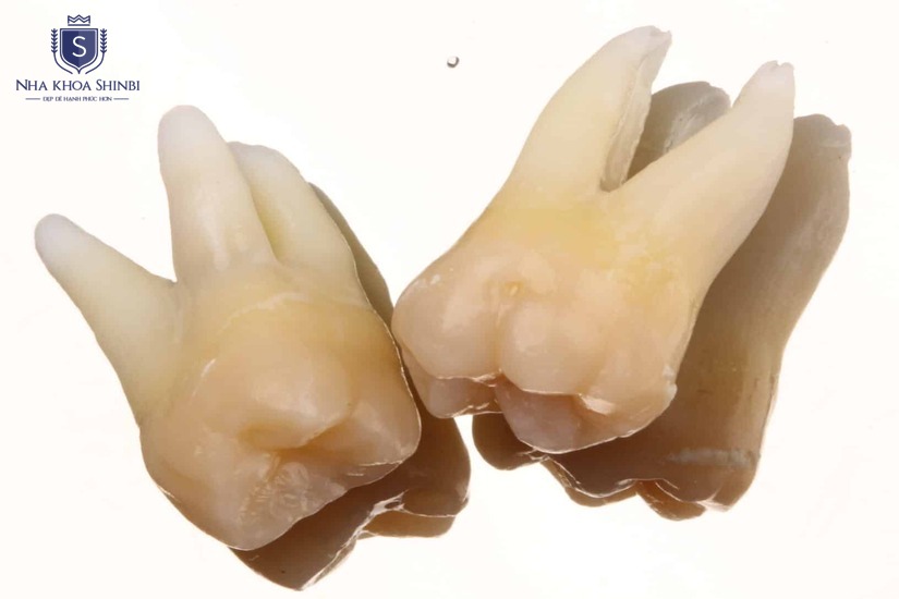 Dịch vụ chuyên nghiệp với chi phí minh bạch