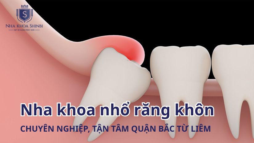 Nha khoa nhổ răng khôn chuyên nghiệp, tận tâm quận Bắc Từ Liêm