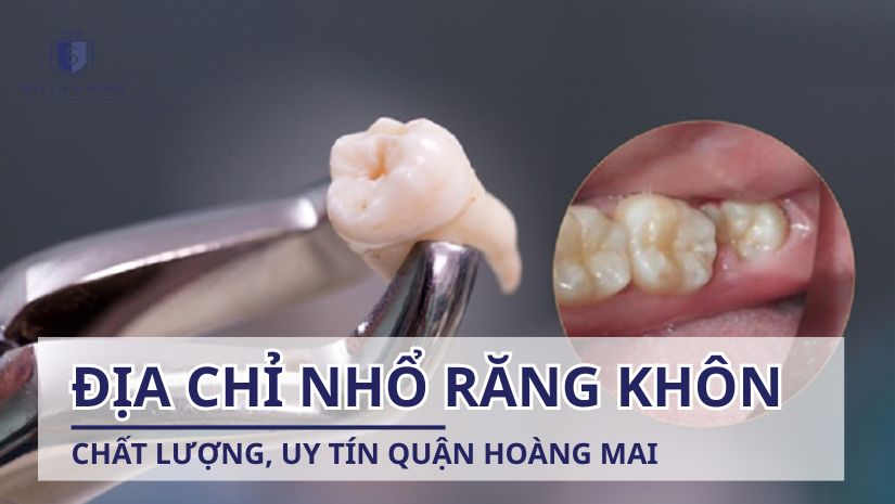 Địa chỉ nhổ răng khôn chất lượng, uy tín quận Hoàng Mai