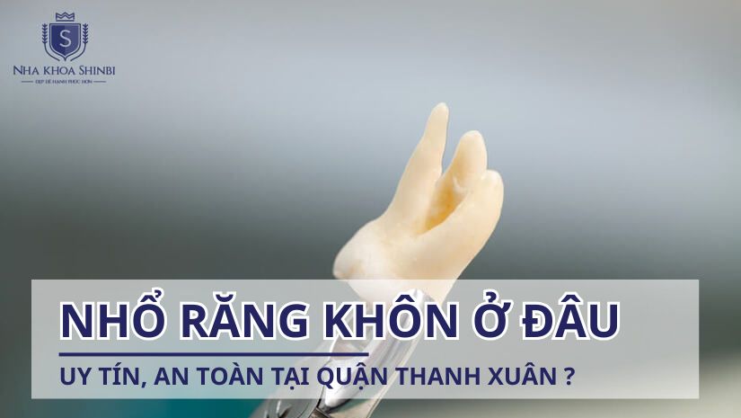 Nhổ răng khôn ở đâu uy tín, an toàn tại quận Thanh Xuân?