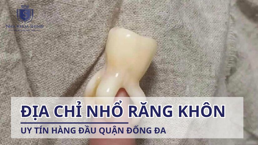 Địa chỉ nhổ răng khôn uy tín hàng đầu quận Đống Đa