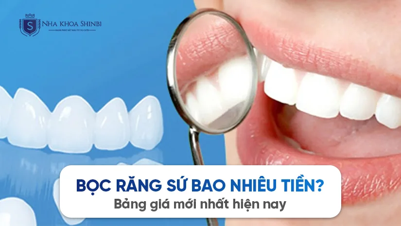 Bọc răng sứ bao nhiêu tiền? Bảng giá mới nhất hiện nay