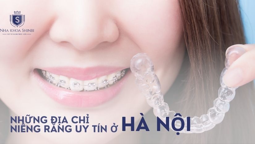 Những địa chỉ niềng răng uy tín, tốt nhất ở Hà Nội